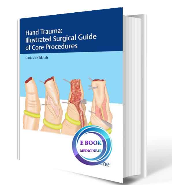 دانلود کتاب Hand Trauma: Illustrated Surgical Guide of Core Procedures2018( PDF)